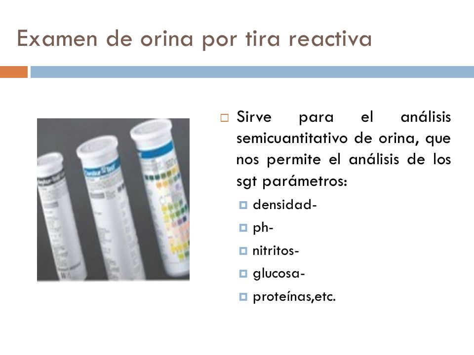 para que sirve un examen de orina para que sirve un examen de orina